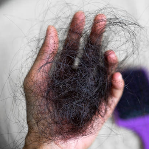 Kesalahan Perawatan Rambut yang Membuat Rambut Rontok