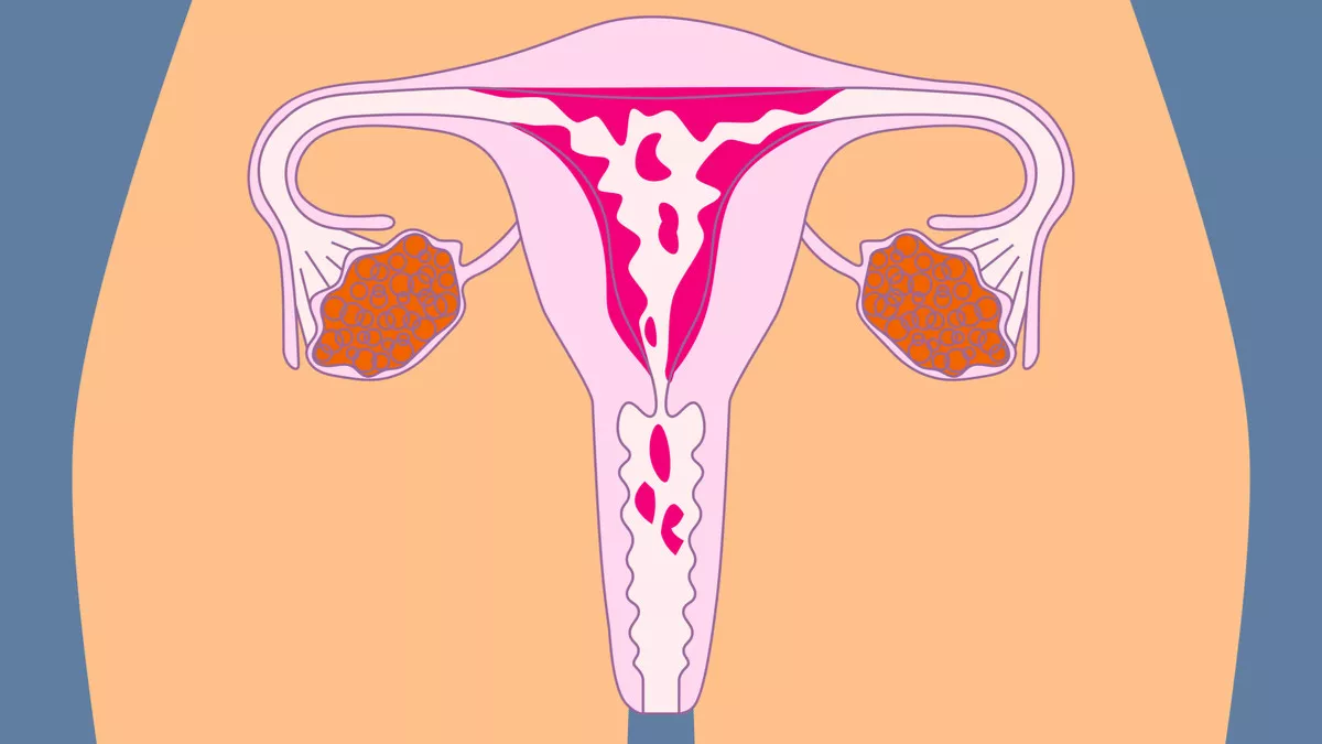 Mengapa Hormon Wanita Berubah Saat Haid? Ini Penjelasan yang Jarang Dibahas Tuntas