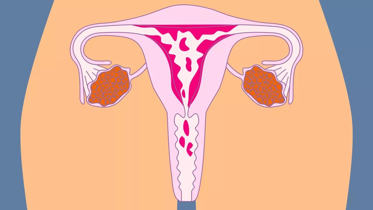 Mengapa Hormon Wanita Berubah Saat Haid? Ini Penjelasan yang Jarang Dibahas Tuntas