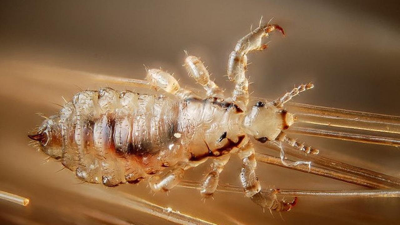Dari Mana Asal Usul Kutu Rambut pada Manusia? Ternyata Sudah Ada Sejak Ribuan Tahun Lalu