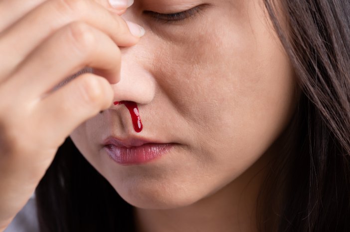 Masih Dongakkan Kepala Saat Mimisan? Ini Kesalahan yang Sering Dilakukan Tanpa Disadari