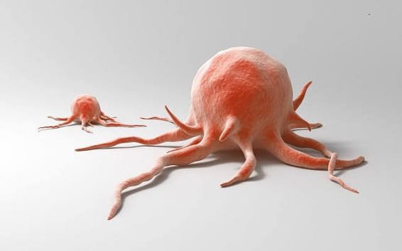 Kanker Bukan Akhir Segalanya: Benarkah Penyakit Ini Tidak Bisa Disembuhkan?