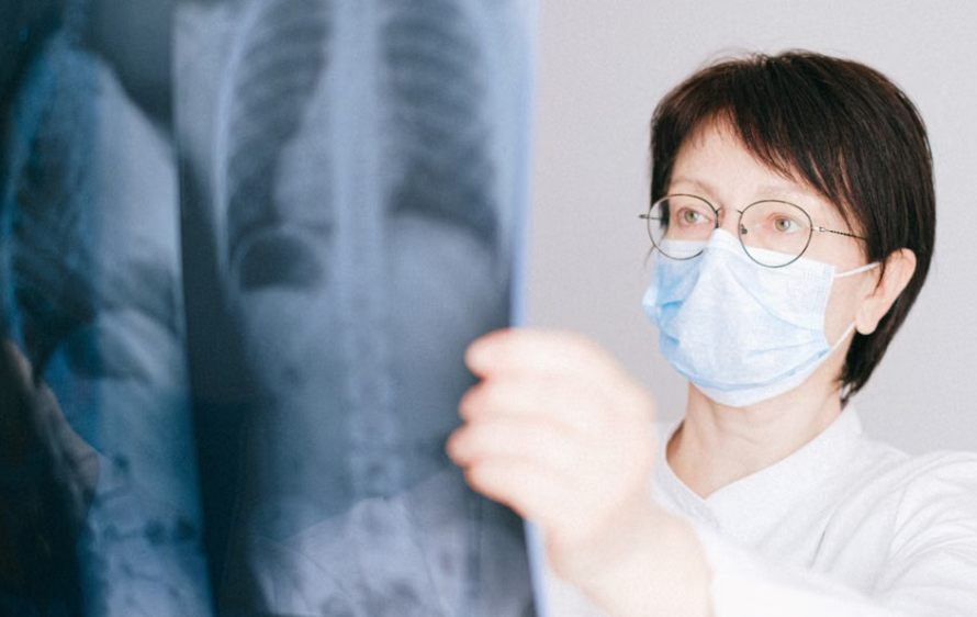Kemenkes Siapkan 10.000 Alat Diagnostik TB untuk Puskesmas, Deteksi Penyakit Ditargetkan Semakin Cepat